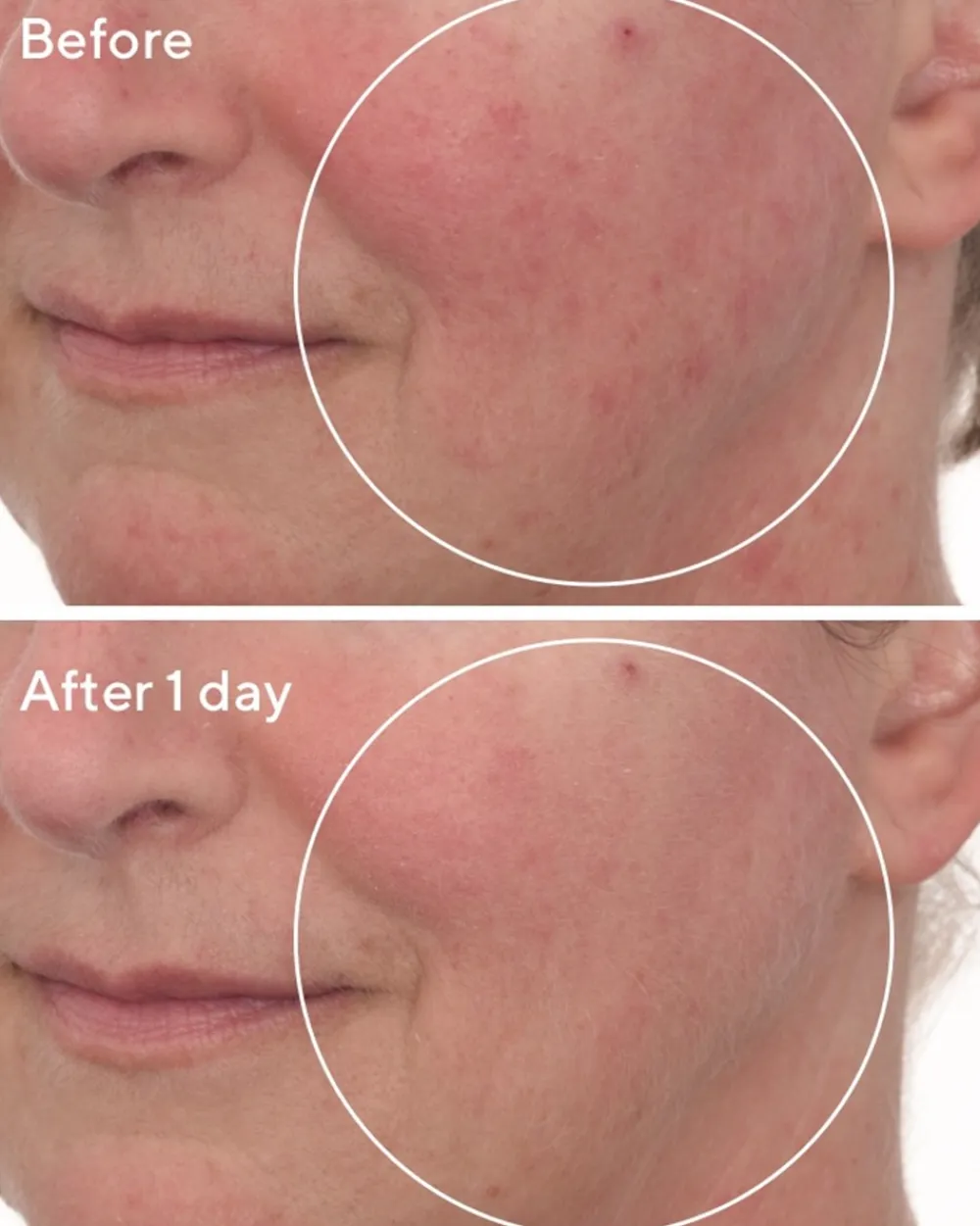Murad Cellular Hydration Repair Mask, 80 ml- Ansigtspleje