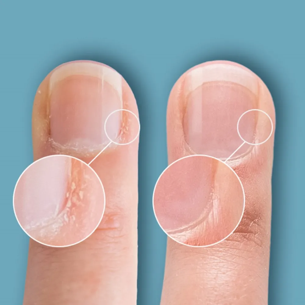 New Cuticle Eraser Negle