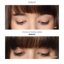 M2 Beauté Eyelash Activating Serum- Øjne