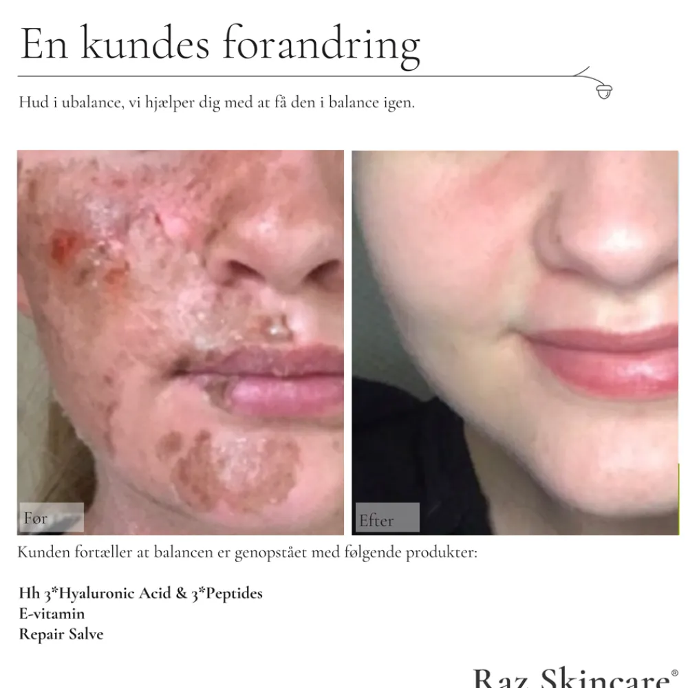 Repair Parfumefri Salve, 15 ml Kropspleje
