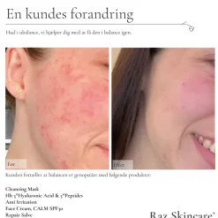 Raz Skincare Repair Salve, 15 ml- Kropspleje|Hudpleje