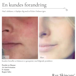 Raz Skincare Repair Salve, 15 ml- Kropspleje|Hudpleje